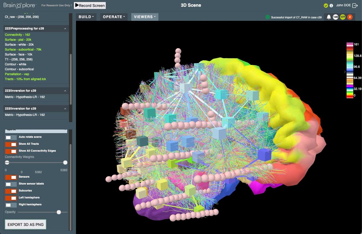 Sample of BrainXplore UI